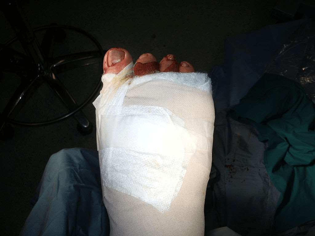 Getting Justice with the Personal Injury Lawyers